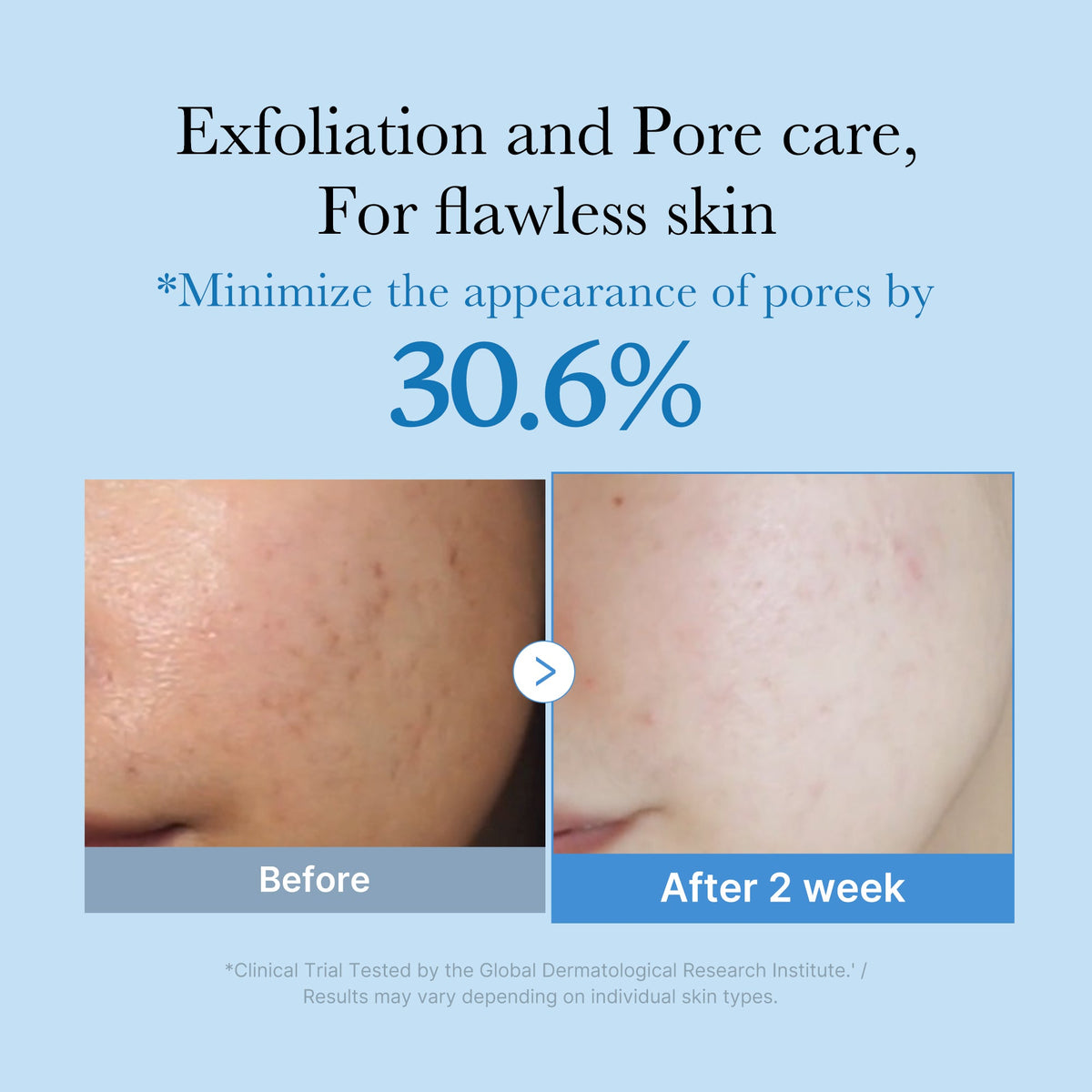 zero-pore-toner-x7 01_d6480b4e-3c08-4954-994a-ed5212c1839c.jpg