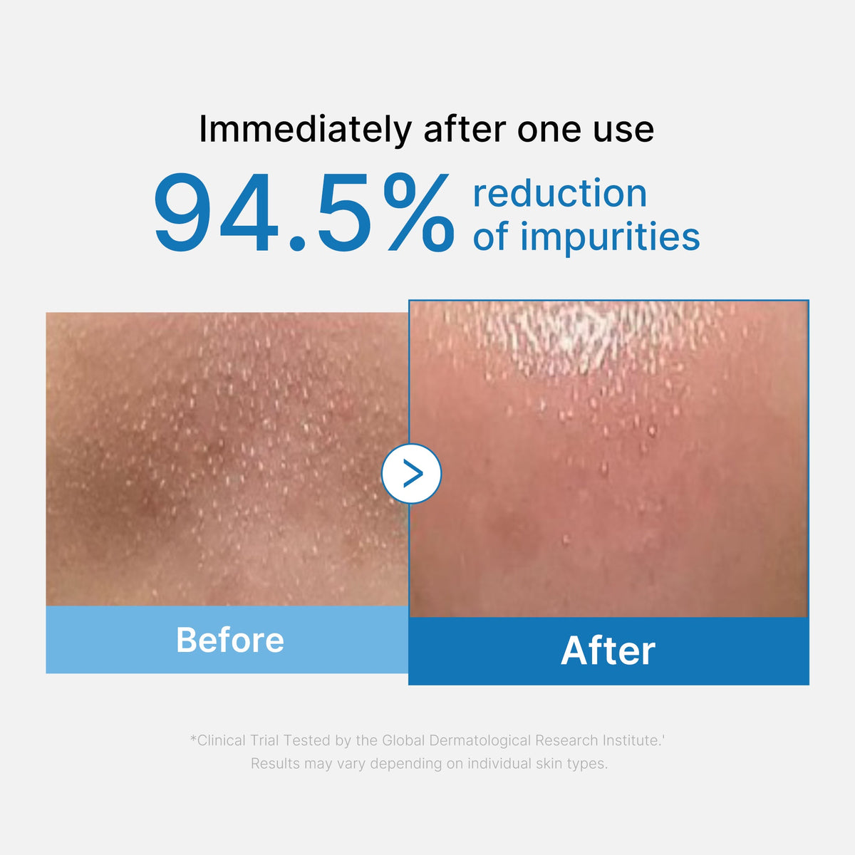 zero-pore-blackhead-deep-cleansing-oil-a9 01_eed557ec-5857-46a2-8b17-dbd67c692dcb.jpg