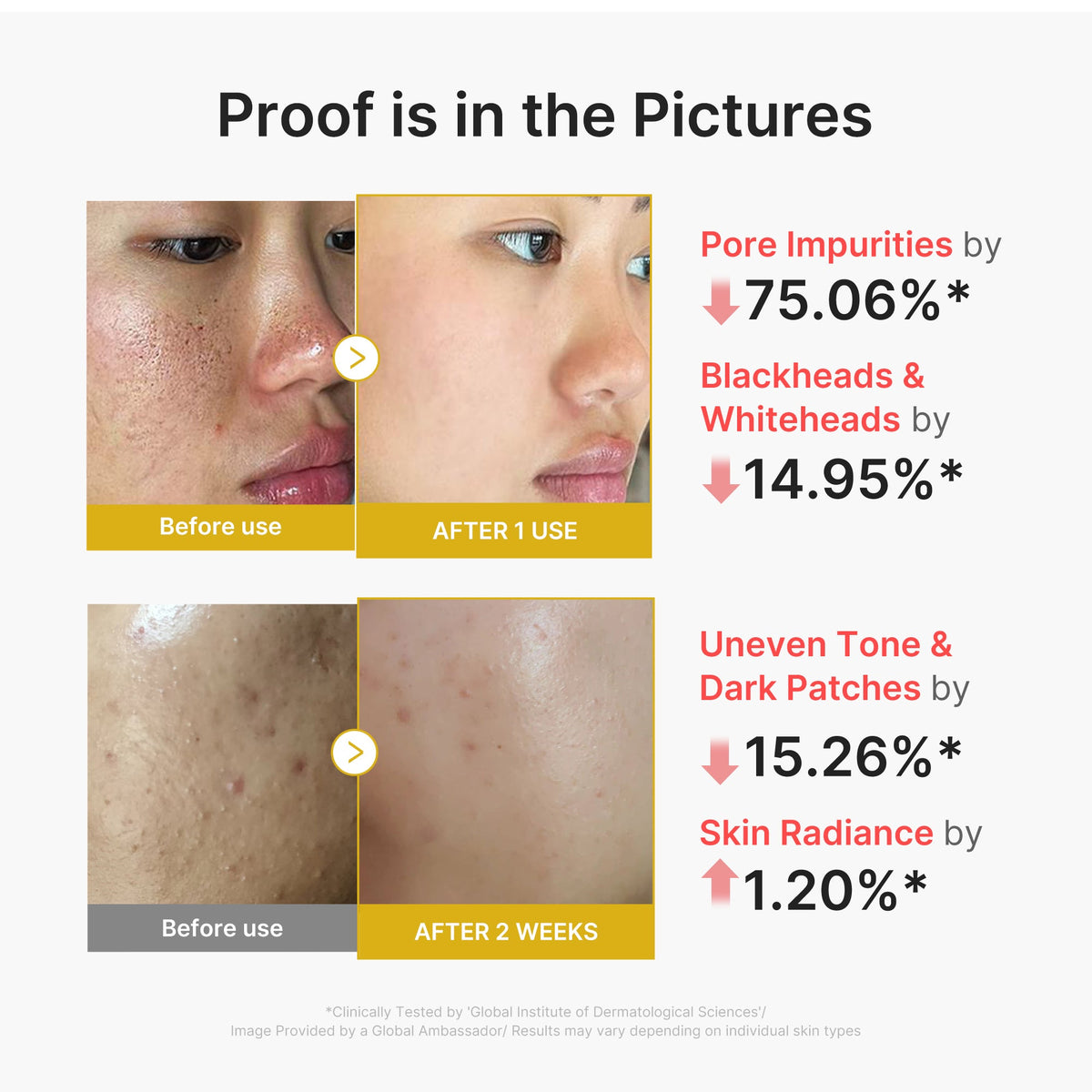 kojic-acid-turmeric-peel-shot-m5 02_45fe66d3-b3f6-4100-aa52-2afd7eded417.jpg