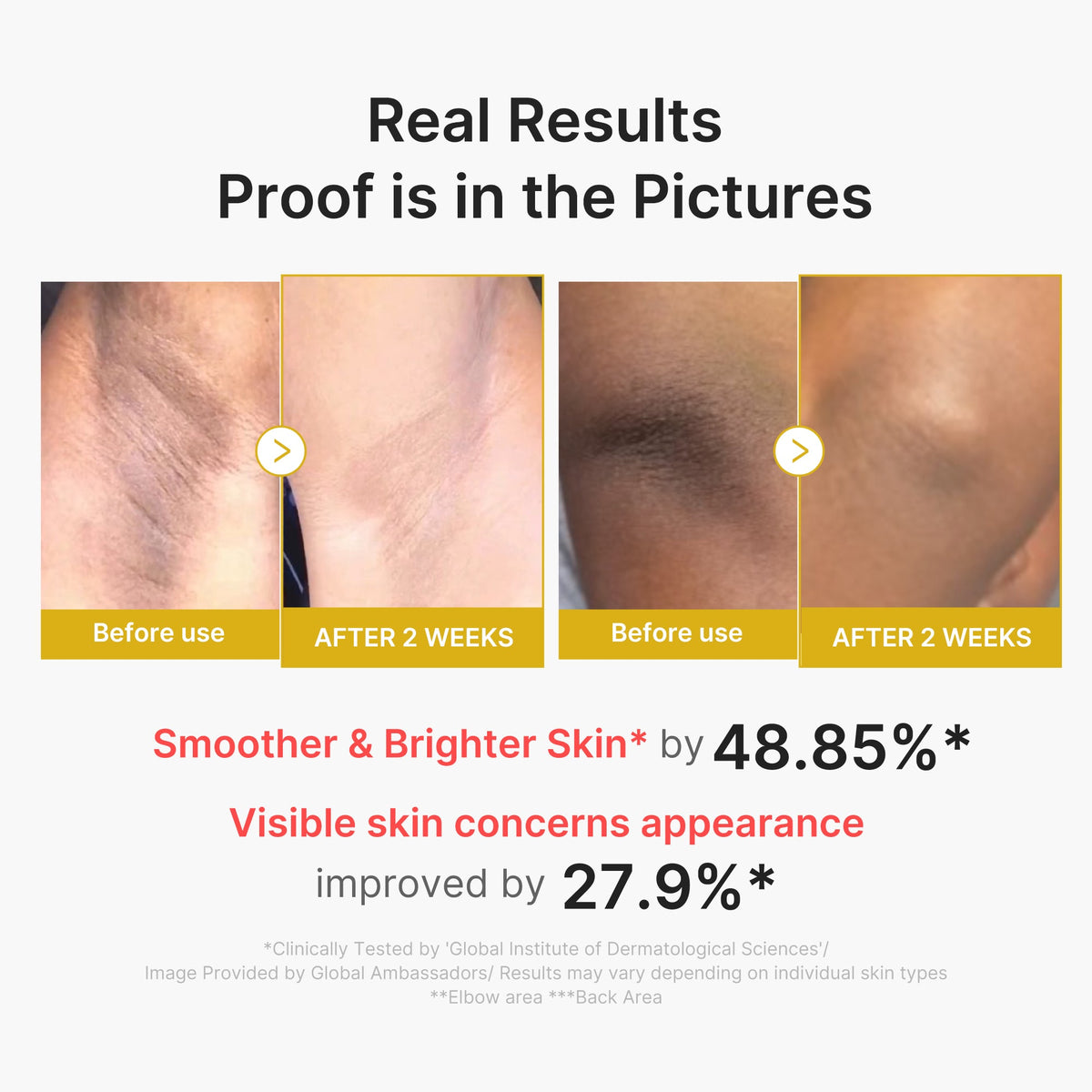 kojic-acid-turmeric-body-peel-shot-b6 02_72880cfc-382b-440b-8152-7e3dce87da2a.jpg