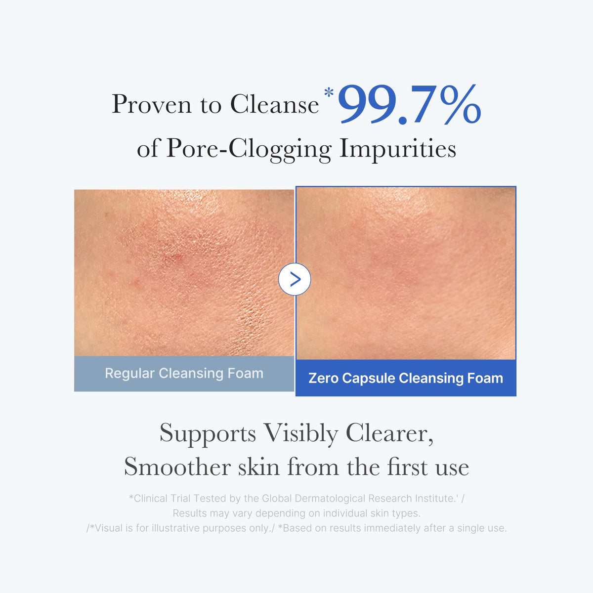 zero-pore-capsule-cleansing-foam-p3 02_c1fb9dfb-86c5-4038-8ff8-490d1006276c.jpg