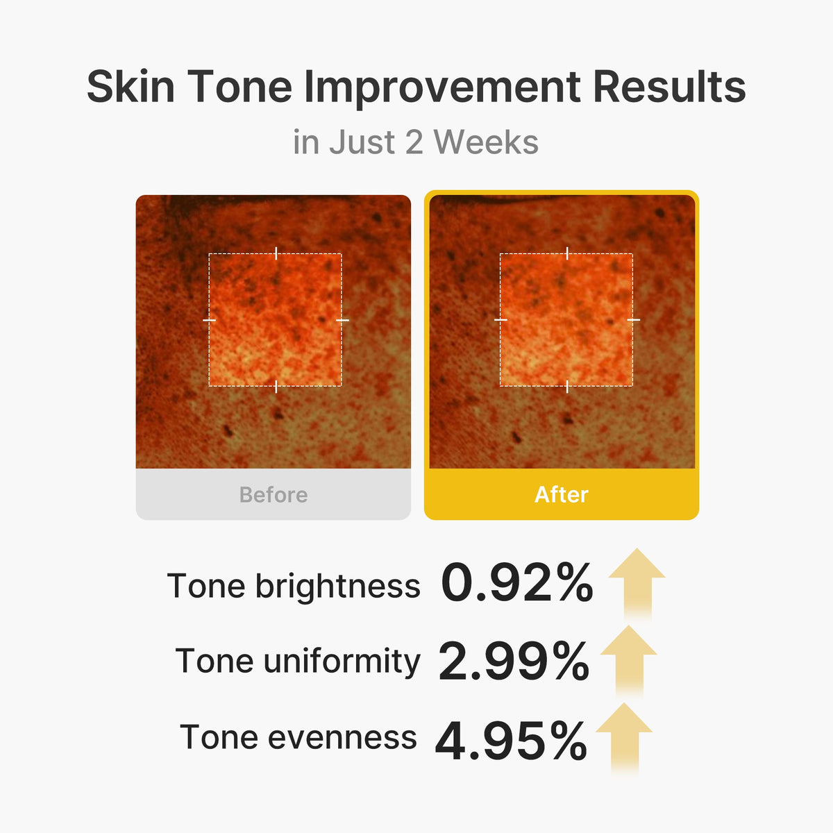 kojic-acid-turmeric-vita-capsule-cream-w4 03_2b626701-fc6c-4702-9e96-a2157a4f7f9d.jpg