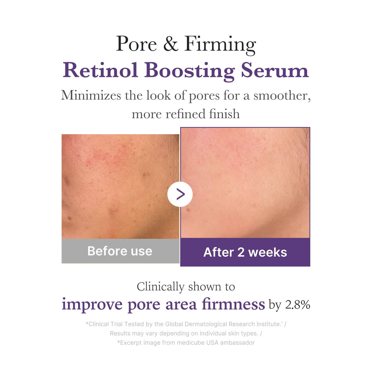 retinol-nmn-boosting-serum-j8 03_3510e7a5-5633-4a18-81ea-1389593bd517.jpg