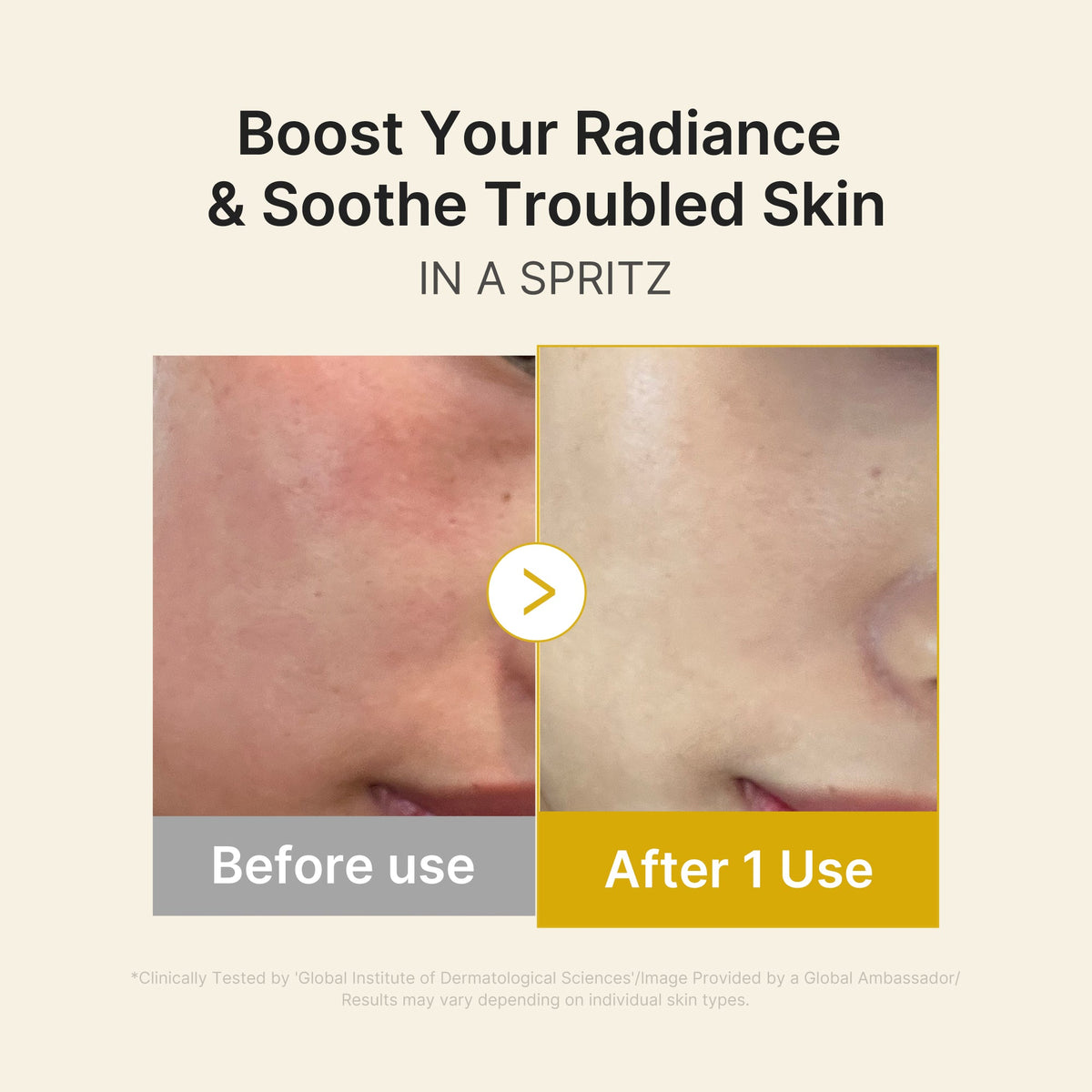 kojic-acid-turmeric-vitamin-gold-jelly-mist-serum-i2 03_dc9cd19e-4e57-49d3-9b66-c7762e8a63f1.jpg