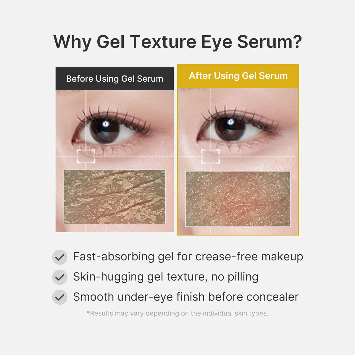 kojic-acid-tumeric-eye-gel-serum-z6 04_0487ef36-49f4-4294-8049-bb55118b05fe.jpg