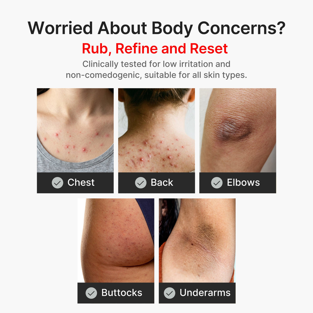 kojic-acid-turmeric-body-peel-shot-b6 04_8a7237f2-3ebf-401e-bd85-54841aeb3efc.jpg