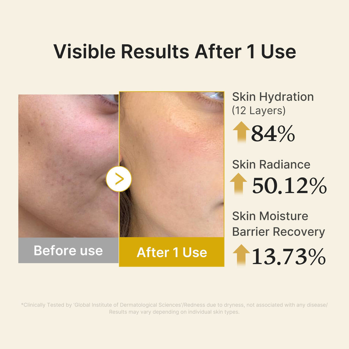 kojic-acid-turmeric-vitamin-gold-jelly-mist-serum-i2 04_d5c55ef1-e03b-494d-bc0d-a1ecc7fc2abf.jpg