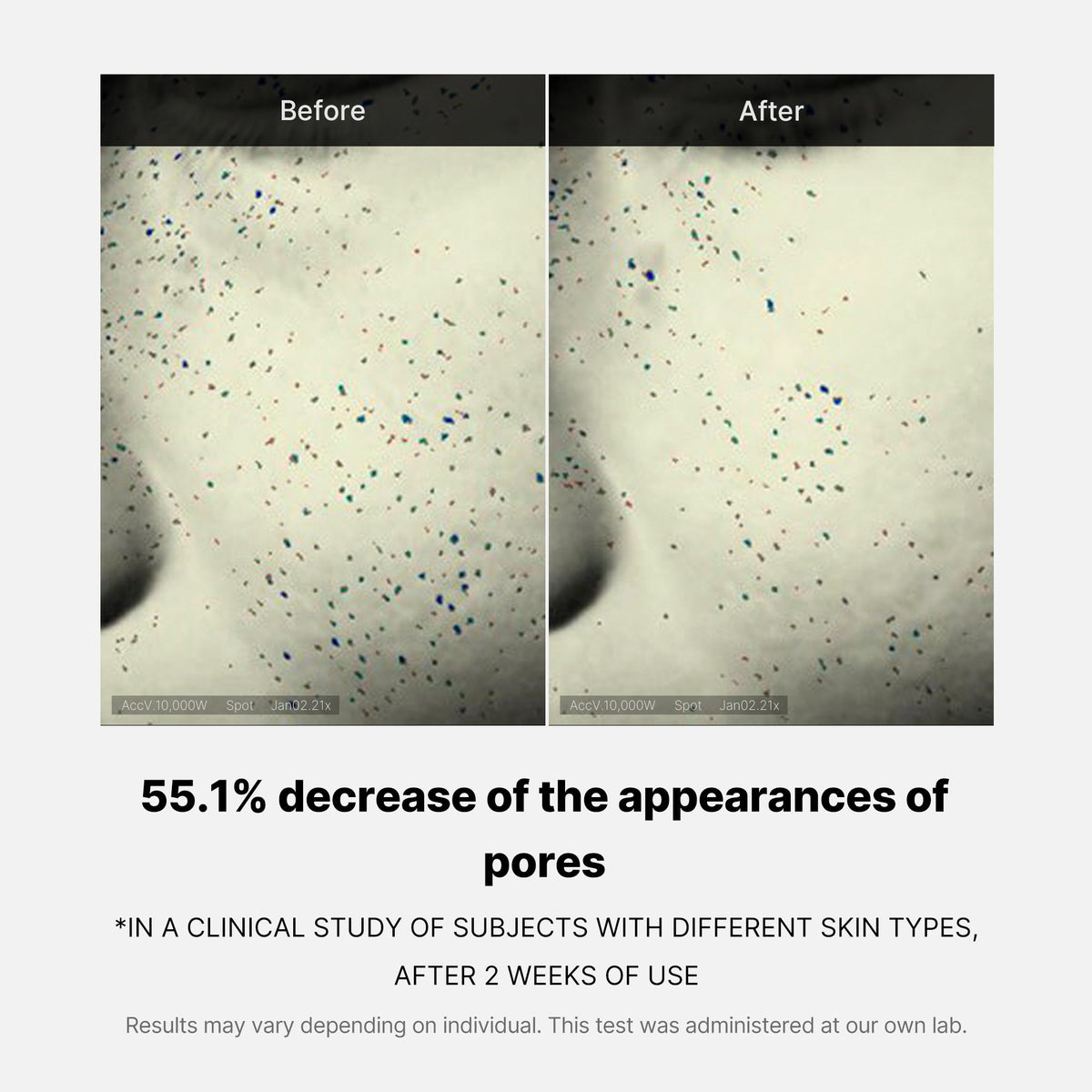 pore-care-duo-f7 05_12ddab8a-64be-4612-8ee1-27e5ec701921.jpg