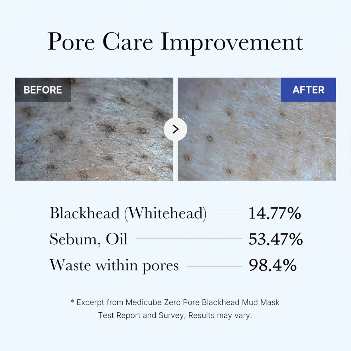 zero-pore-blackhead-mud-mask-b3 05_9362a158-c2b3-4525-acc0-631a2cfdea47.jpg