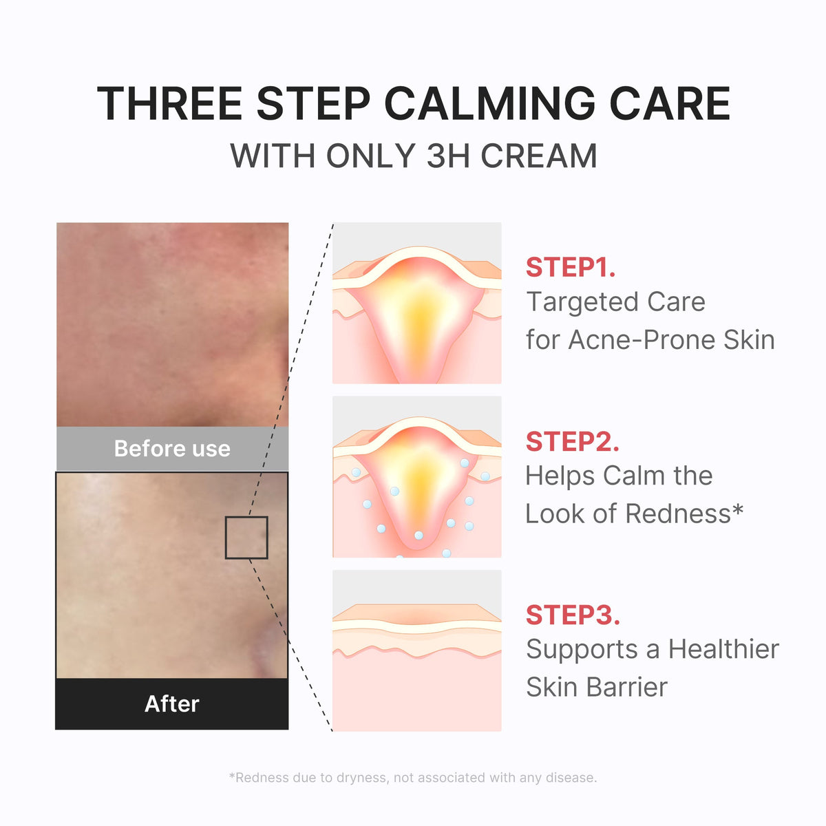 3h-daily-relief-cream-h0 3H_04.jpg