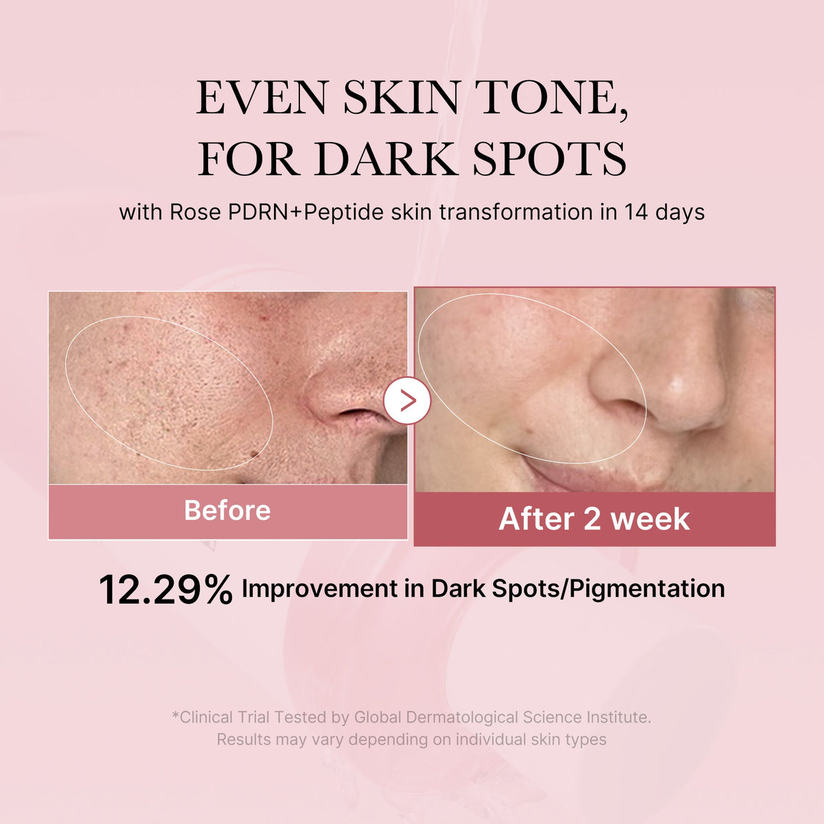 pdrn-pink-peptide-toner-p6 PDRN_01_308c518e-5ac6-4e54-99bd-eabc8796739b.jpg
