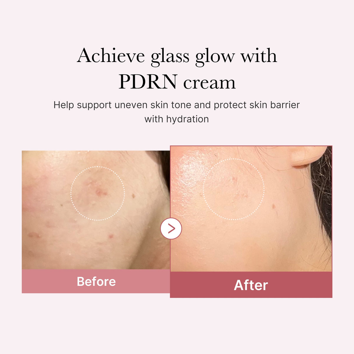 pdrn-pink-peptide-cream-h5 PDRN_02_d7805bfe-cf43-446a-b71b-a276683f136b.jpg