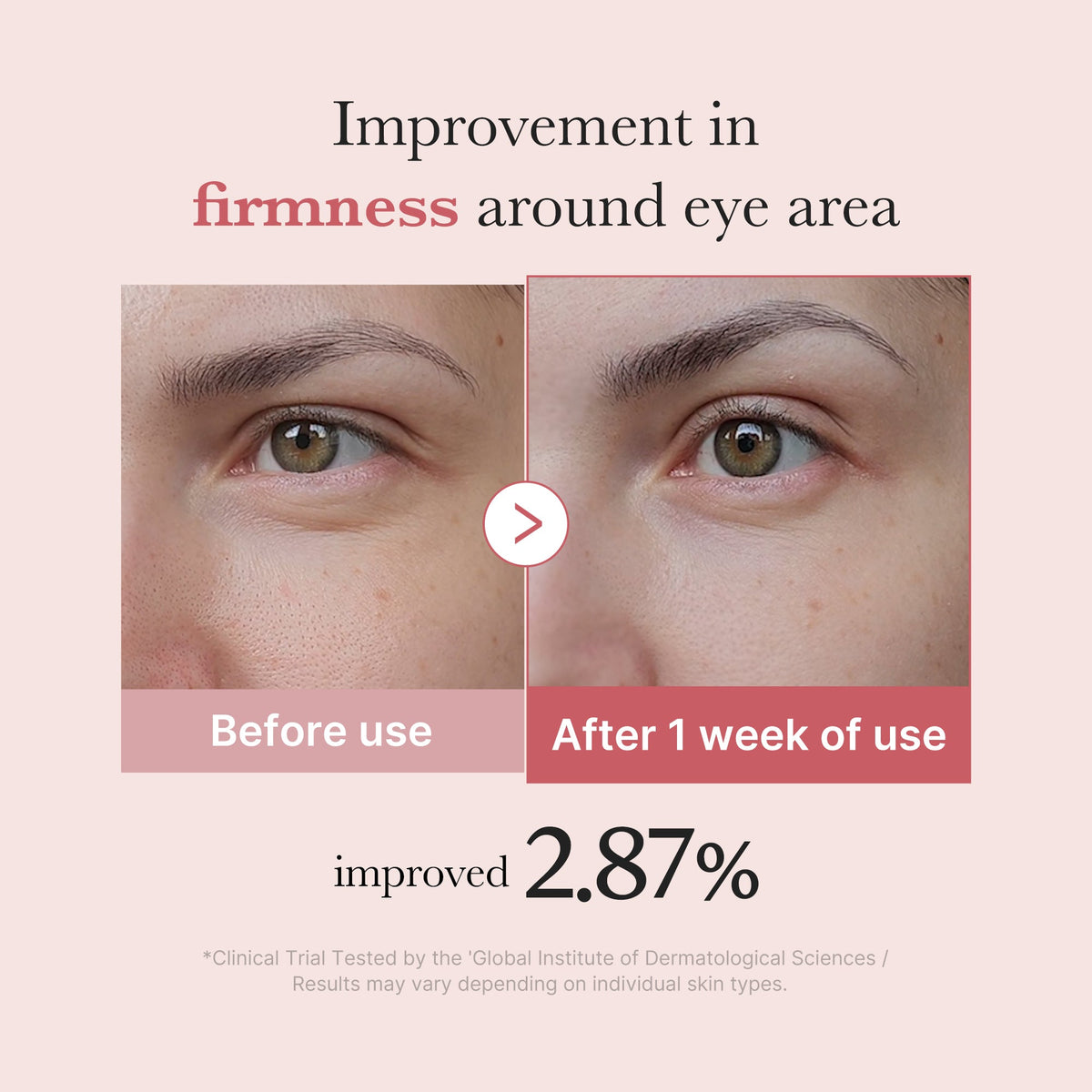 pdrn-pink-peptide-eye-cream-b8 PDRN_03_256dd753-0a2f-41b4-b3cd-bbfd3bc27018.jpg