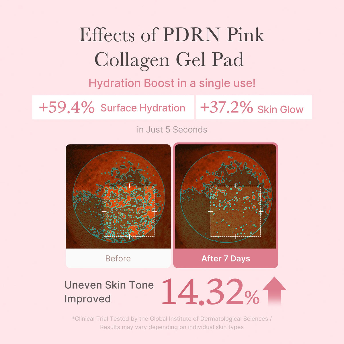pdrn-pink-collagen-gel-toner-pad-k4 PDRN_04_f9a16a56-8d9e-4c47-a635-ed34ec3ed571.jpg
