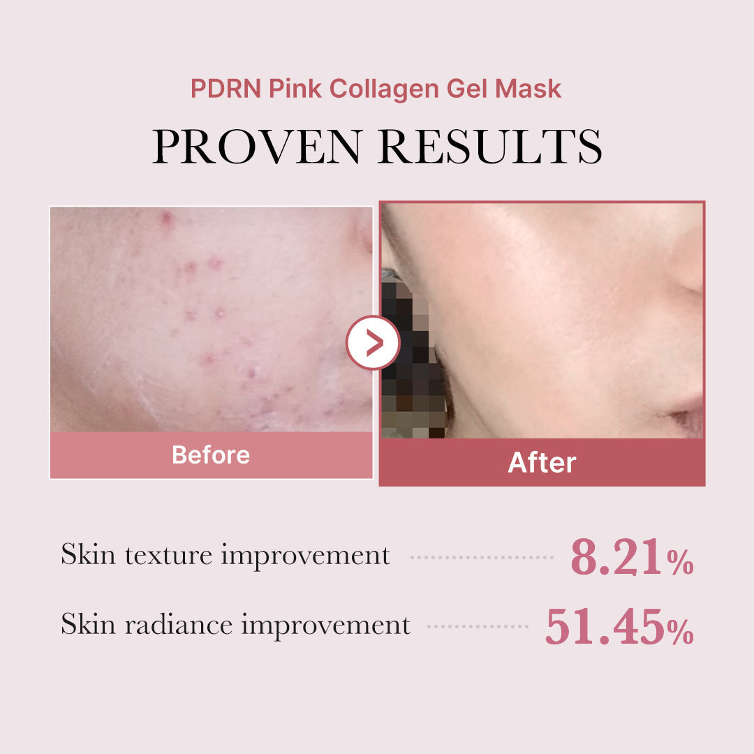 pdrn-pink-glow-full-set-r9 PDRN_12.jpg